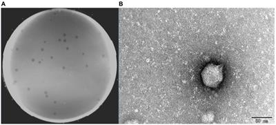 Potential application of a newly isolated phage BUCT609 infecting Stenotrophomonas maltophilia